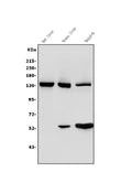 Anti-Ceruloplasmin/CP Antibody Picoband®