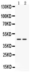 Anti-Cathepsin K/CTSK Antibody Picoband®