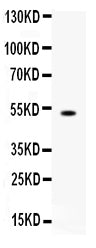 Anti-FCGRT Antibody Picoband®