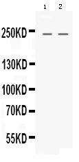 Anti-Nestin Antibody Picoband®