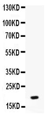 Anti-NAP2/PPBP Antibody Picoband®