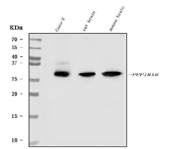 Anti-DARPP32/PPP1R1B Antibody Picoband®