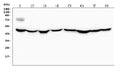 Anti-Ribonuclease Inhibitor/RNH1 Antibody Picoband®