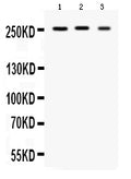 Anti-Scn1a Antibody Picoband®