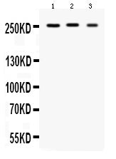 Anti-Scn1a Antibody Picoband®
