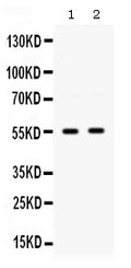 Anti-GLUT9/SLC2A9 Antibody Picoband®