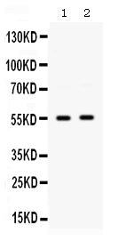 Anti-GLUT9/SLC2A9 Antibody Picoband®