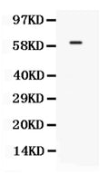 Anti-TCF7L1 Antibody Picoband®