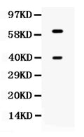 Anti-TPP1 Antibody Picoband®