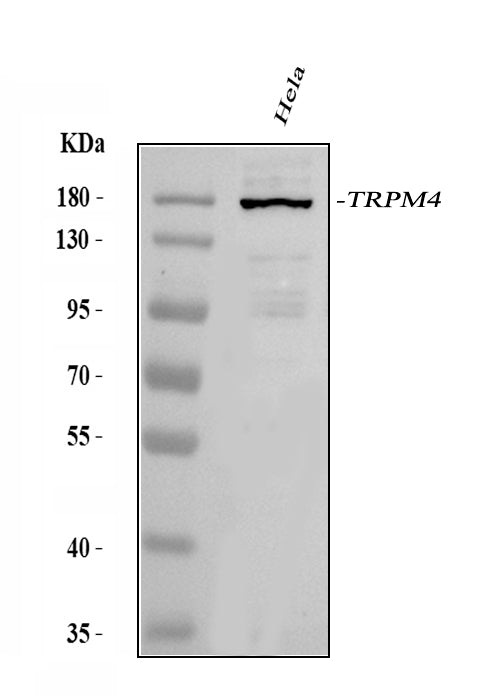 Anti-TRPM4 Antibody Picoband®
