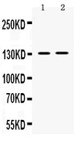 Anti-TRPM5 Antibody Picoband®