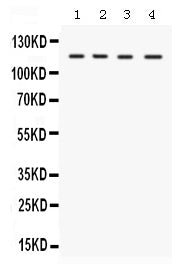 Anti-E1 Ubiquitin Activating Enzyme/UBA1 Antibody Picoband®