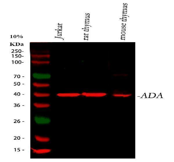 Anti-ADA Antibody Picoband®