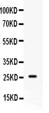Anti-Apolipoprotein A I/APOA1 Antibody Picoband®