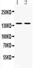 Anti-Calcium Sensing Receptor/CASR Antibody Picoband®