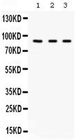 Anti-Factor B/CFB Antibody Picoband®
