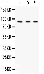 Anti-Factor B/CFB Antibody Picoband®