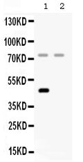 Anti-Factor I/CFI Antibody Picoband®