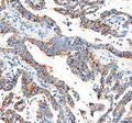 Anti-Calcitonin/CALCA Antibody