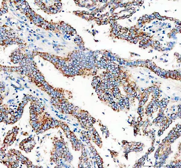 Anti-Calcitonin/CALCA Antibody