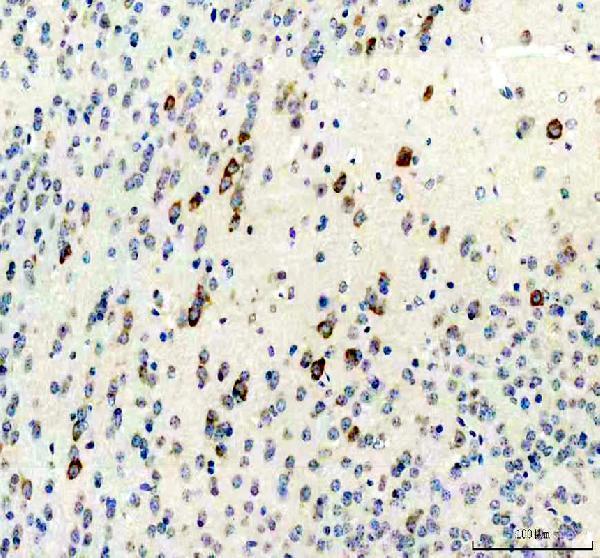 Anti-Calcitonin/CALCA Antibody