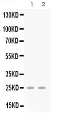 Anti-GRO gamma/CXCL3 Antibody Picoband®