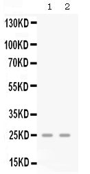 Anti-GRO gamma/CXCL3 Antibody Picoband®