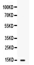 Anti-Intestinal FABP/FABP2 Antibody Picoband®