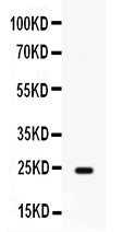 Anti-FGF1 Antibody Picoband®