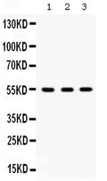 Anti-Integrin linked ILK Antibody Picoband®