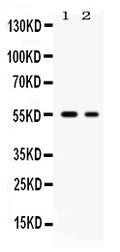 Anti-Glucose Transporter 5 GLUT5/SLC2A5 Antibody Picoband®