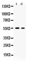Anti-Glucose Transporter 5 GLUT5/SLC2A5 Antibody Picoband®