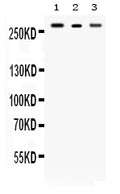 Anti-Talin 2/TLN2 Antibody Picoband®