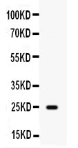 Anti-HE4/WFDC2 Antibody Picoband®