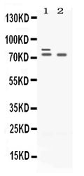 Anti-Plzf/ZBTB16 Antibody Picoband®