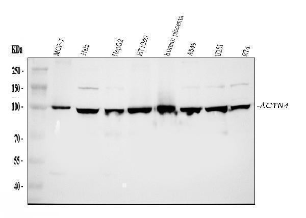 Anti-Alpha Actinin 4/ACTN4 Antibody Picoband®