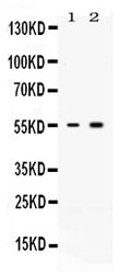 Anti-Activin Receptor Type IIB/ACVR2B Antibody Picoband®