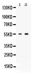 Anti-Activin Receptor Type IIB/ACVR2B Antibody Picoband®