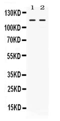 Anti-Argonaute 4/AGO4 Antibody Picoband®