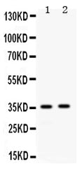Anti-Apolipoprotein E/APOE Antibody Picoband®