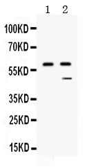 Anti-Carboxypeptidase B2/CPB2 Antibody Picoband®