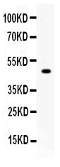 Anti-Carboxypeptidase B2/CPB2 Antibody Picoband®