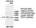 Anti-PDCL Antibody – Figure 1 of 1