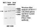 Anti-PHACTR4 Antibody – Figure 1 of 1