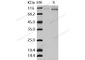 Recombinant Human AGO2/Argonaute 2/EIF2C2 Protein (His Tag) – Figure 1 of 2