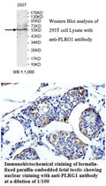 Anti-PLRG1 Antibody – Figure 1 of 1