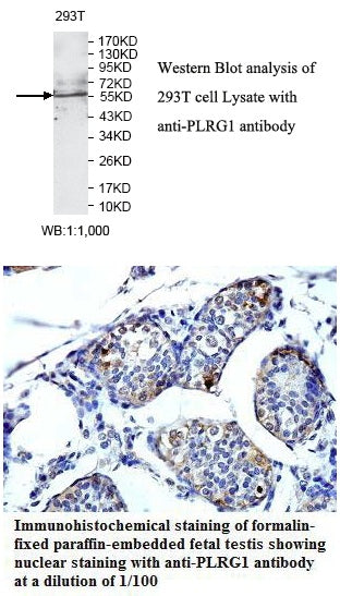 Anti-PLRG1 Antibody – Figure 1 of 1