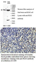 Anti-PLS3 Antibody – Figure 1 of 1