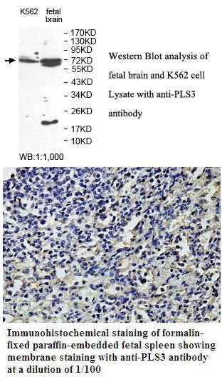 Anti-PLS3 Antibody – Figure 1 of 1