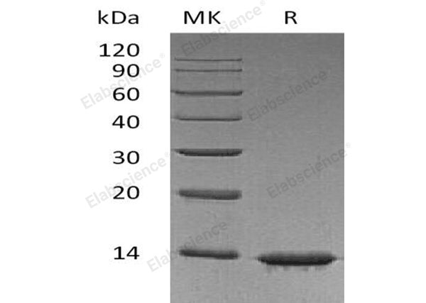 Recombinant Human Leptin Protein – Figure 1 of 2